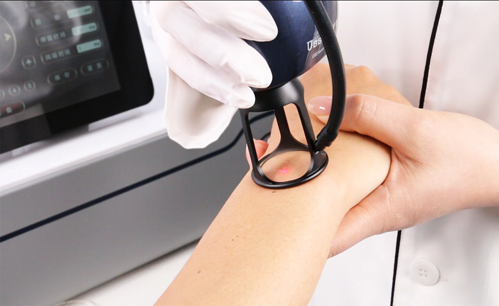 co2 laser skin rejuvenation